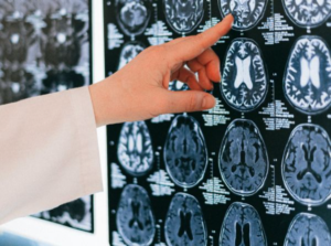 Doctor analyzing brain MRI scans for neurological assessment and diagnosis